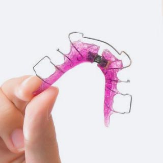 Traditional Removable Retainers
