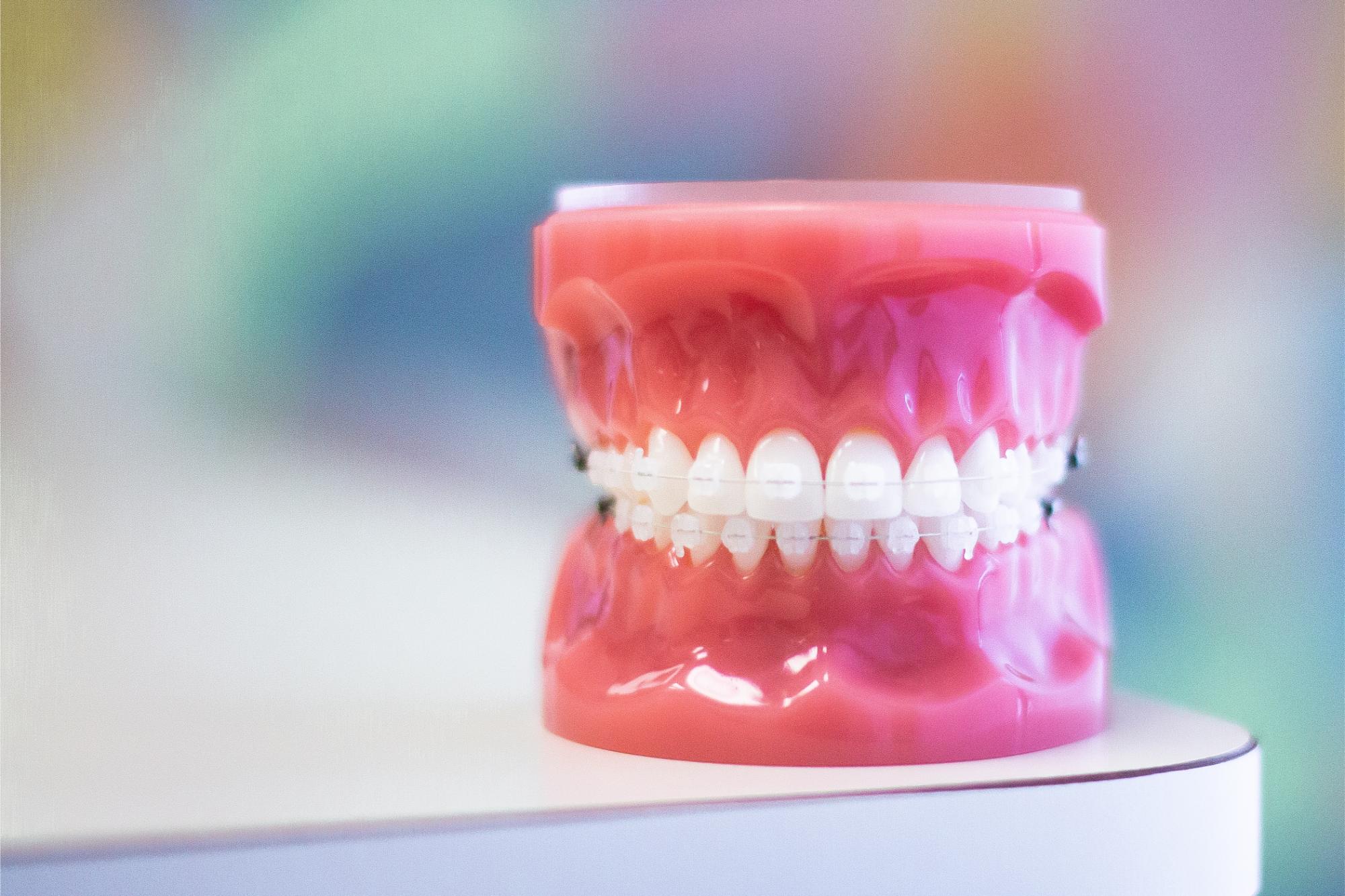 invisalign lafayette la