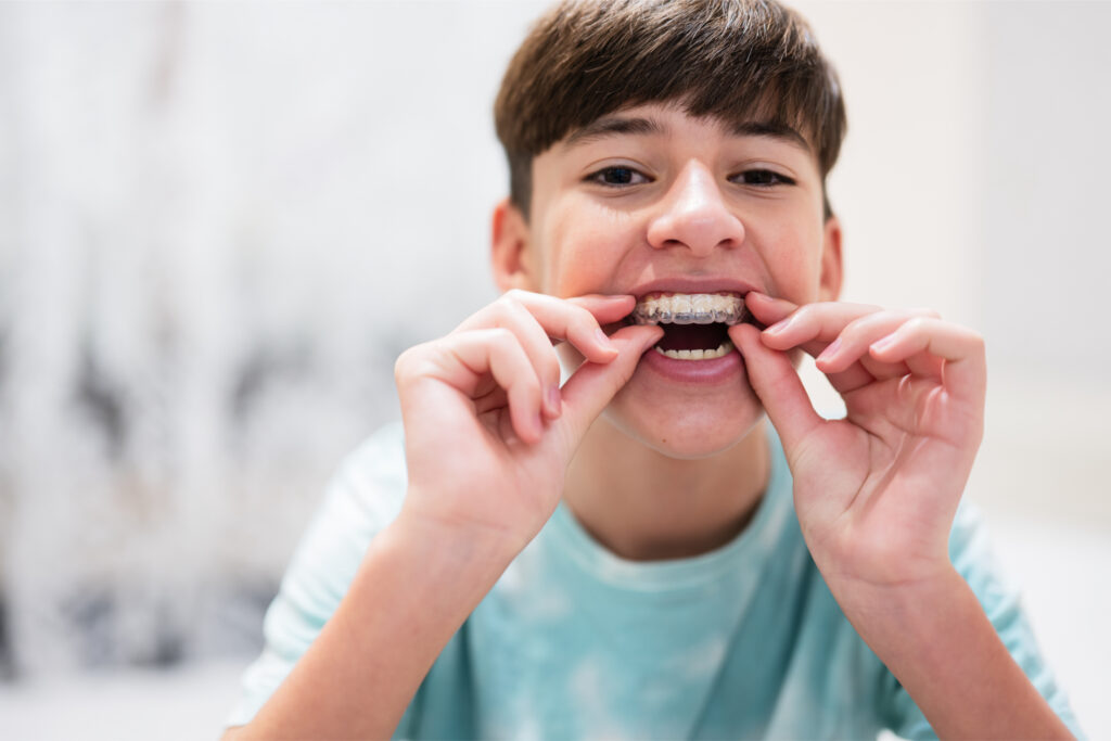 Invisalign clear aligners offered at Balhoff Orthodontics in Lafayette, LA
