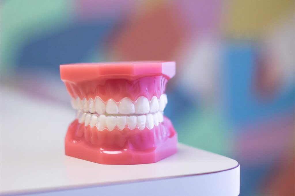model of Invisalign at Balhoff Orthodontics in Lafayette, LA