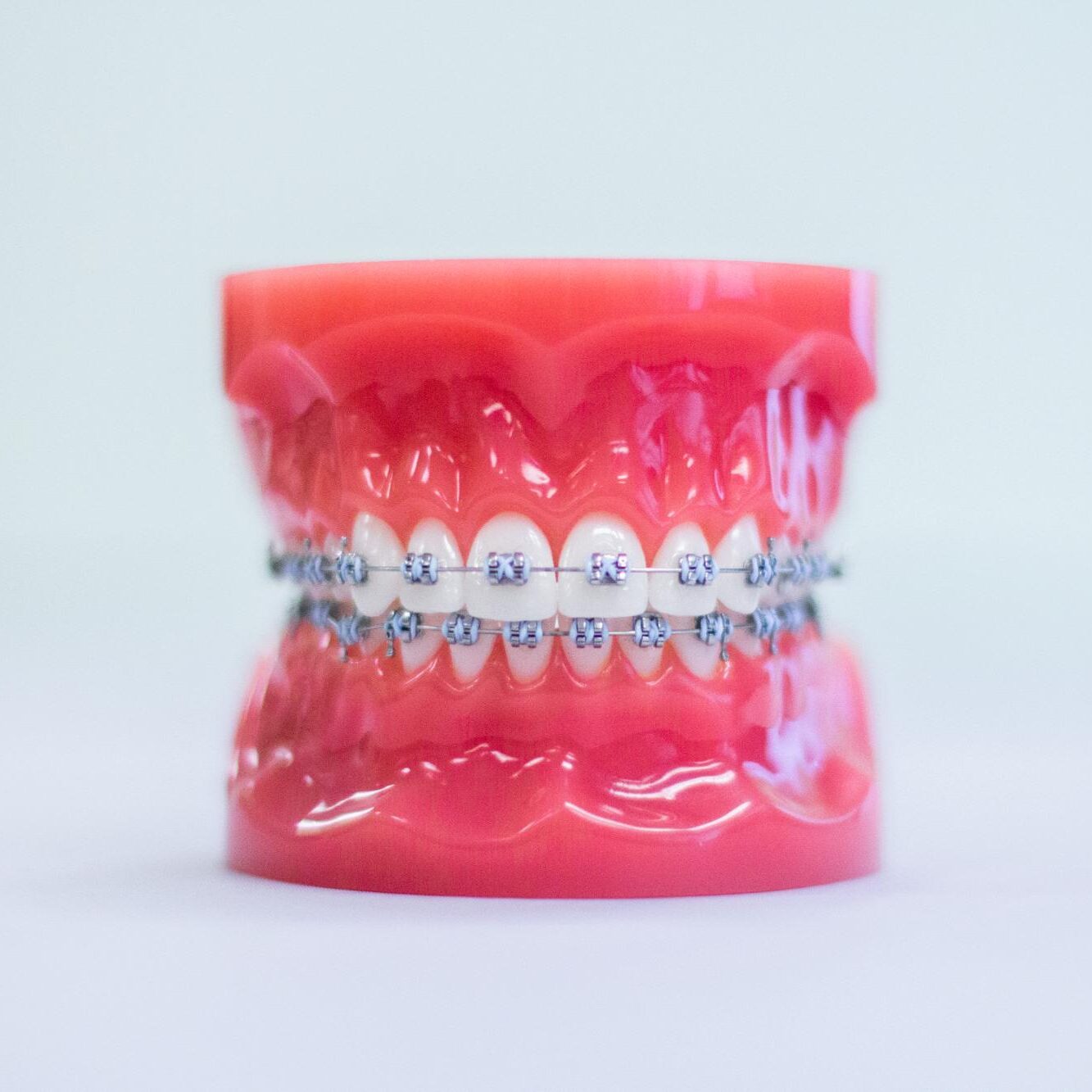 braces lafayette la